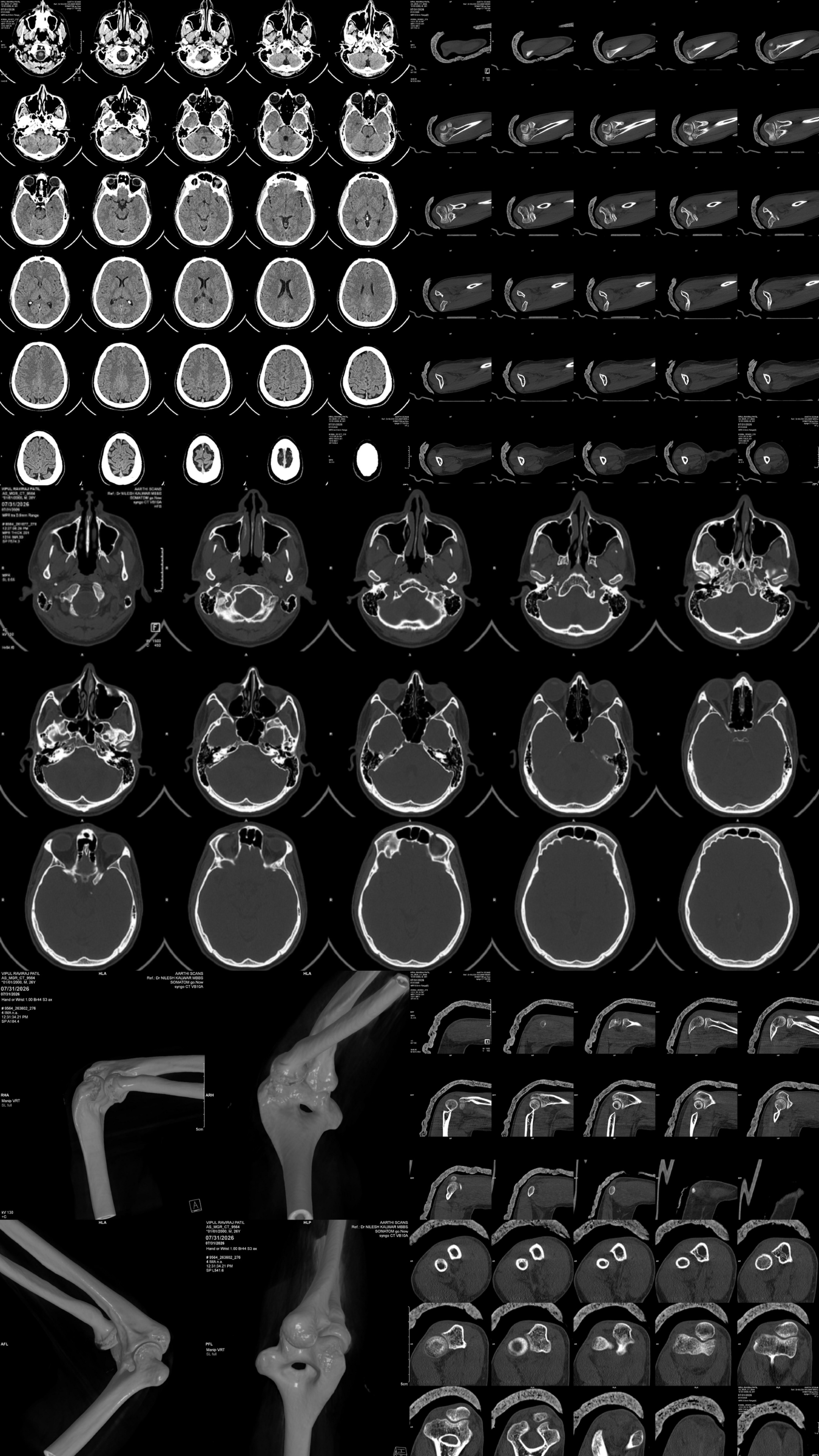 X-Ray